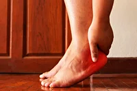 واکاوی درد‌های کف پا از نگاه طب فیزیکی و توانبخشی